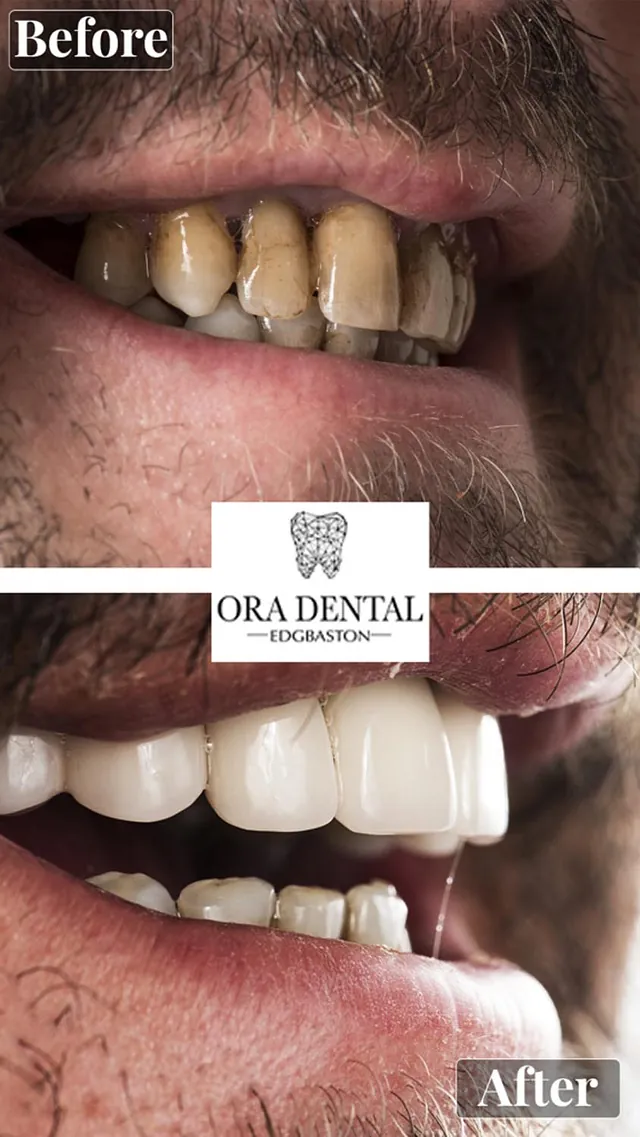 Before & After Ora Dental